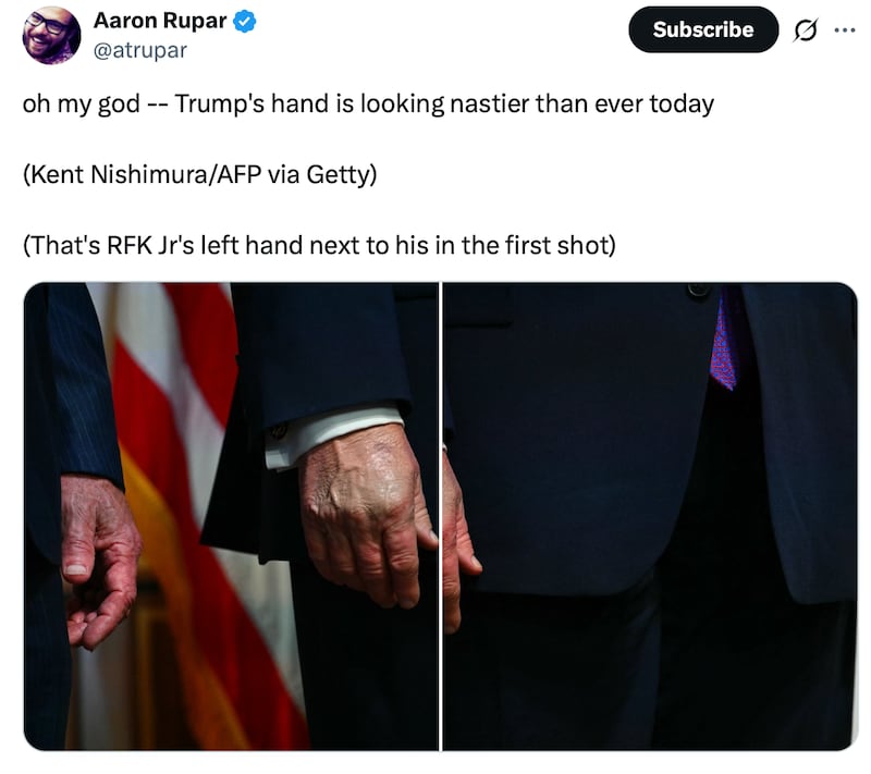 Aaron Rupar comments on the MAGA hands.