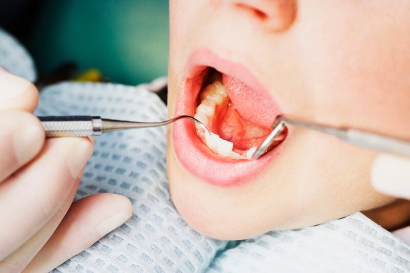 articles/2012/07/16/can-children-s-dental-fillings-spur-depression/dental-fillings-depression-williams_nmohnn