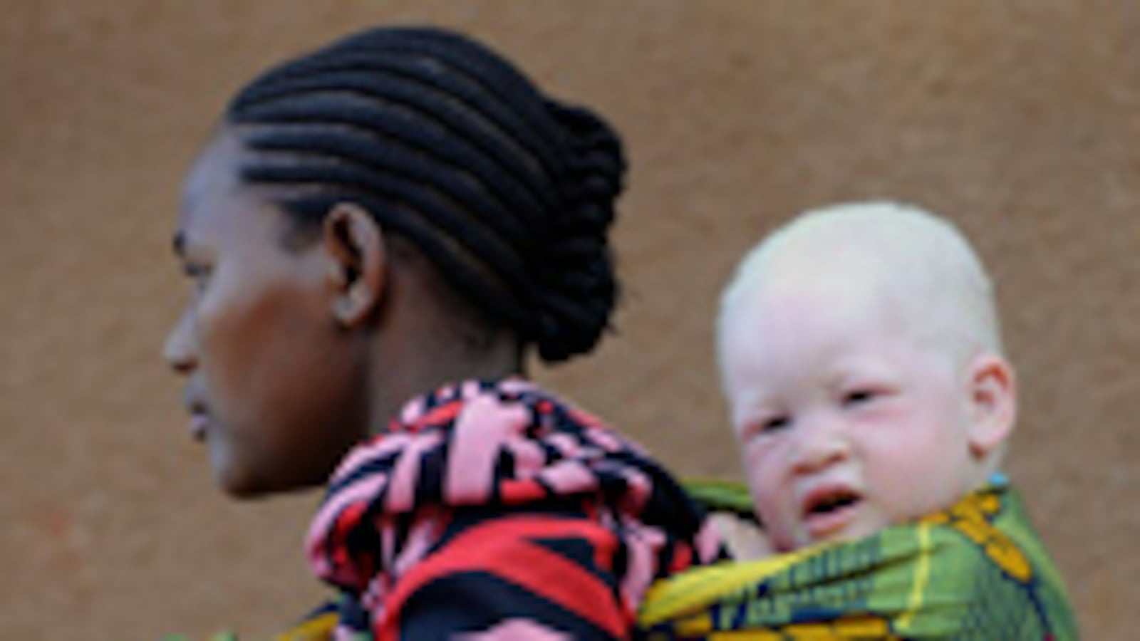 articles/2010/08/27/juju-chang-albino-crimes-seeing-improvement-in-africa/chang-albino-murders_122696_llbubm