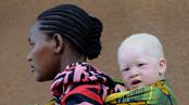 articles/2010/08/27/juju-chang-albino-crimes-seeing-improvement-in-africa/chang-albino-murders_122696_llbubm