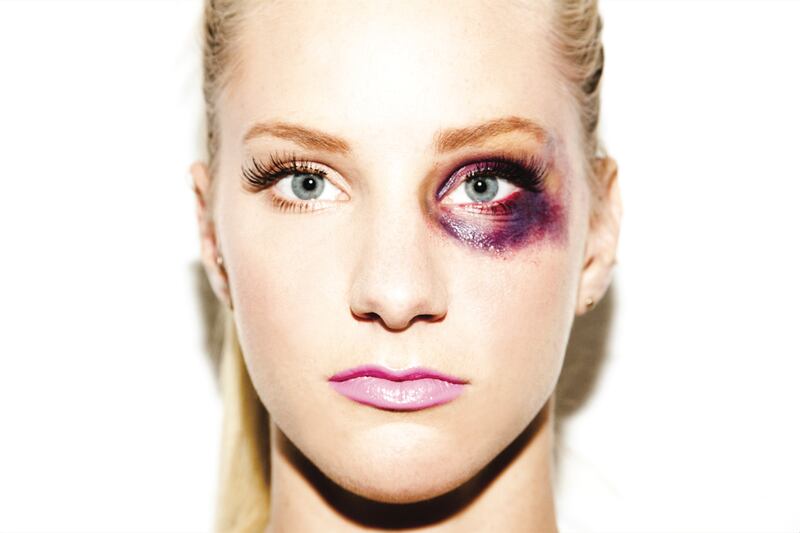 galleries/2013/11/06/celebrity-photographer-tyler-shields-exposes-the-dirty-side-of-glamour-photos/tyler-shields-morris_qjtpm5