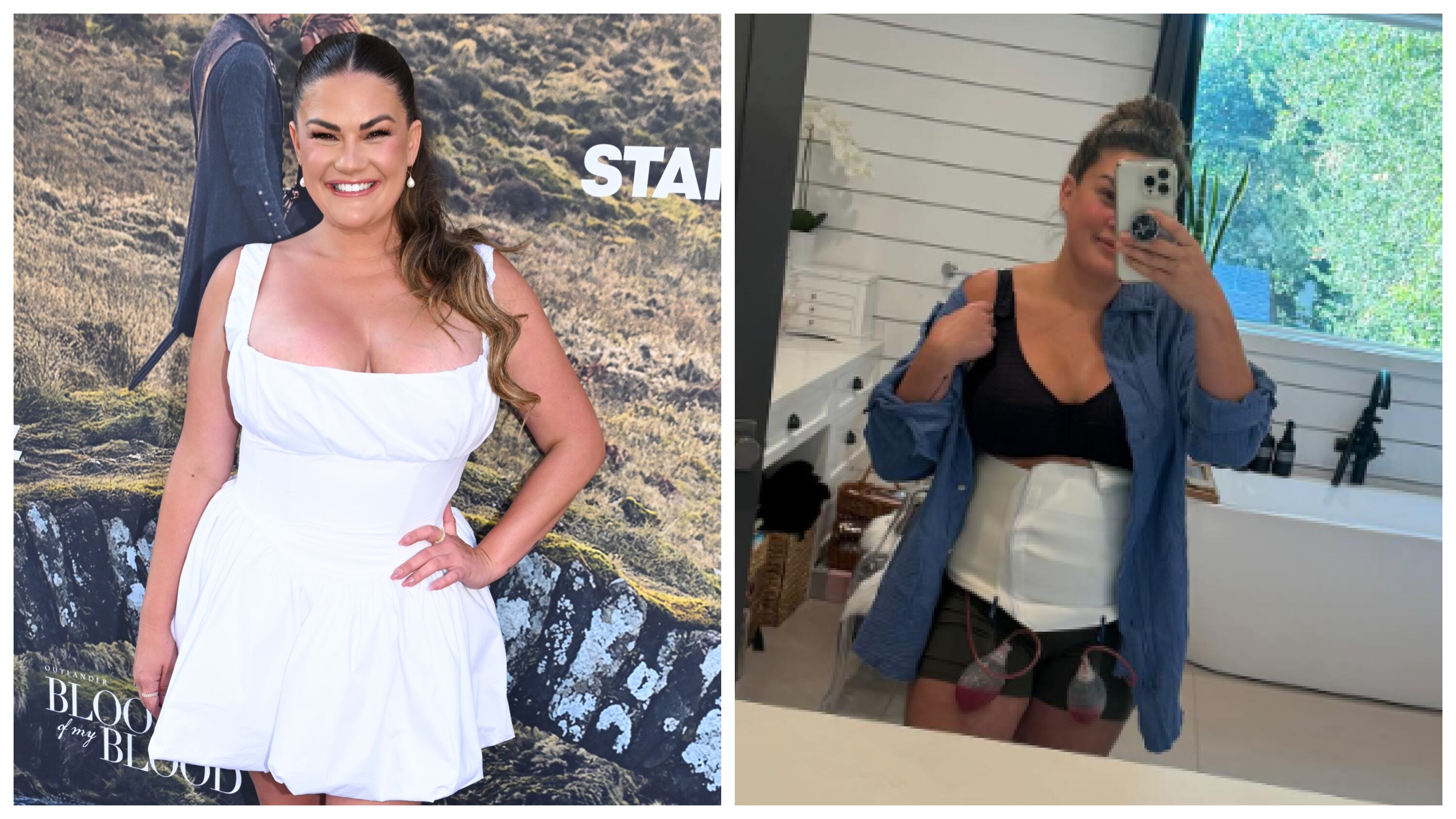 Brittany Cartwright in September 2025 (L) and during the healing process in October 2025.