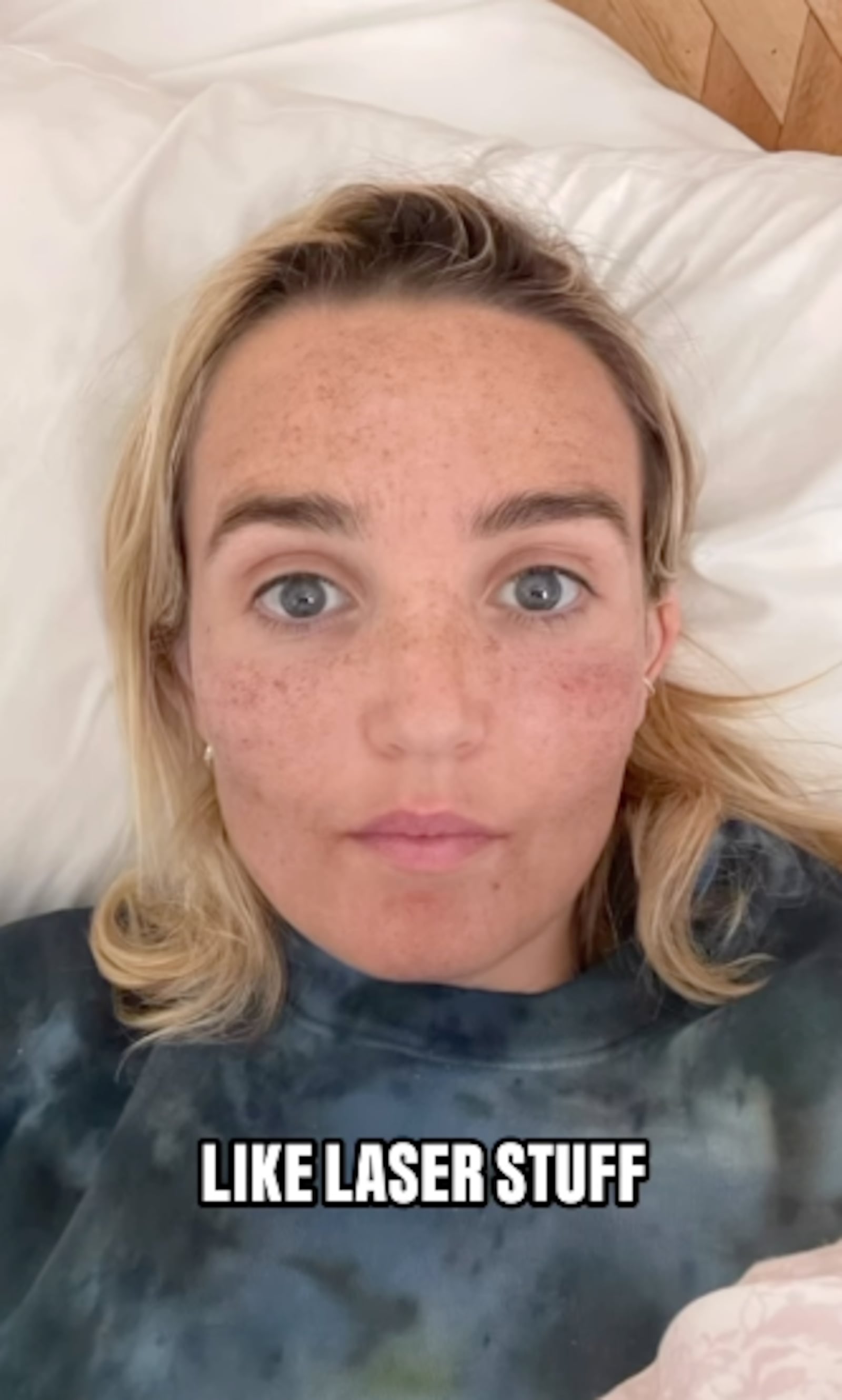 Chloe Fineman shared photos from her "Botched" album on Instagram.