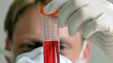 cheats/2009/06/30/drug-resistant-swine-flu-found/swine-flu-6_bx5nds