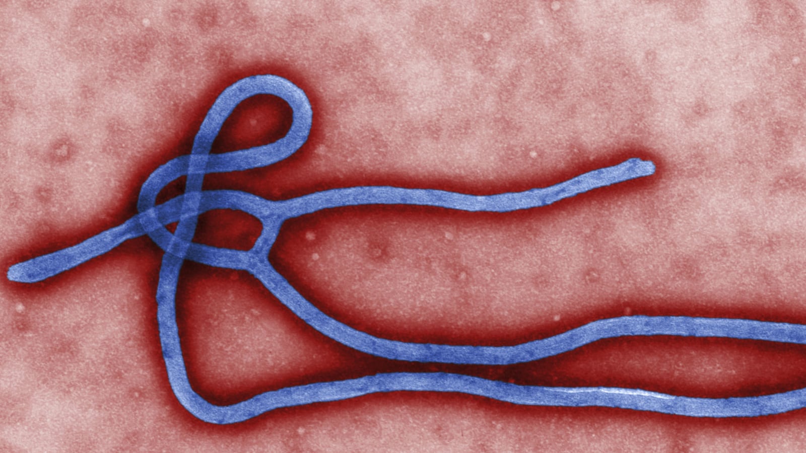 cheats/2014/08/06/cdc-issues-highest-alert-over-ebola/140806-ebolacdc-cheat_ltqd6q