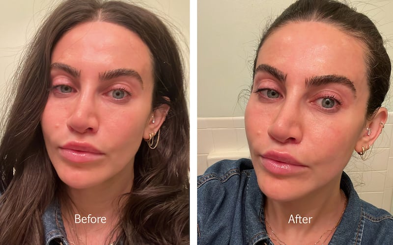 Nuface Before and After Review