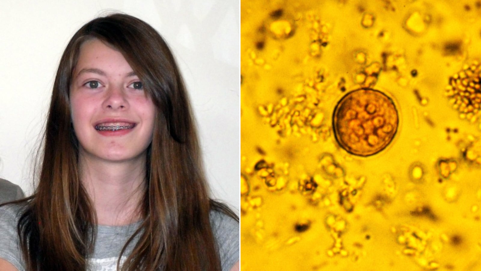 articles/2011/09/13/food-safety-system-endangers-americans-due-to-lack-of-inspectors-budget-cuts/food-safety-conant_vd16ss