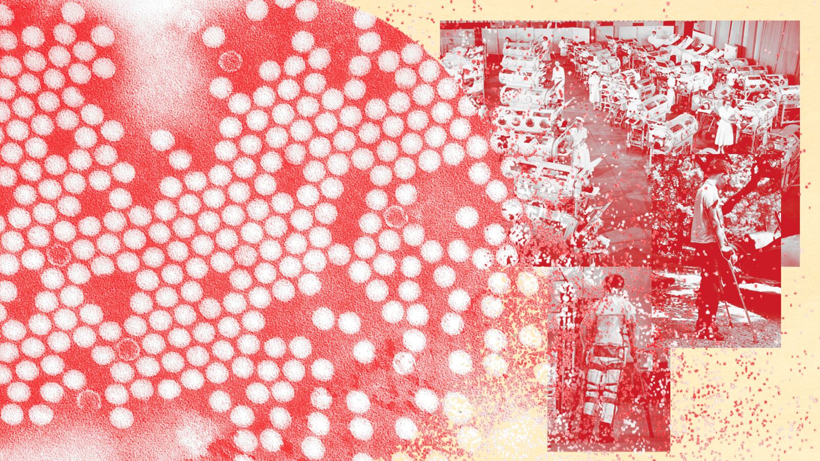 220820-axe-polio-crisis-hero_uymwvw