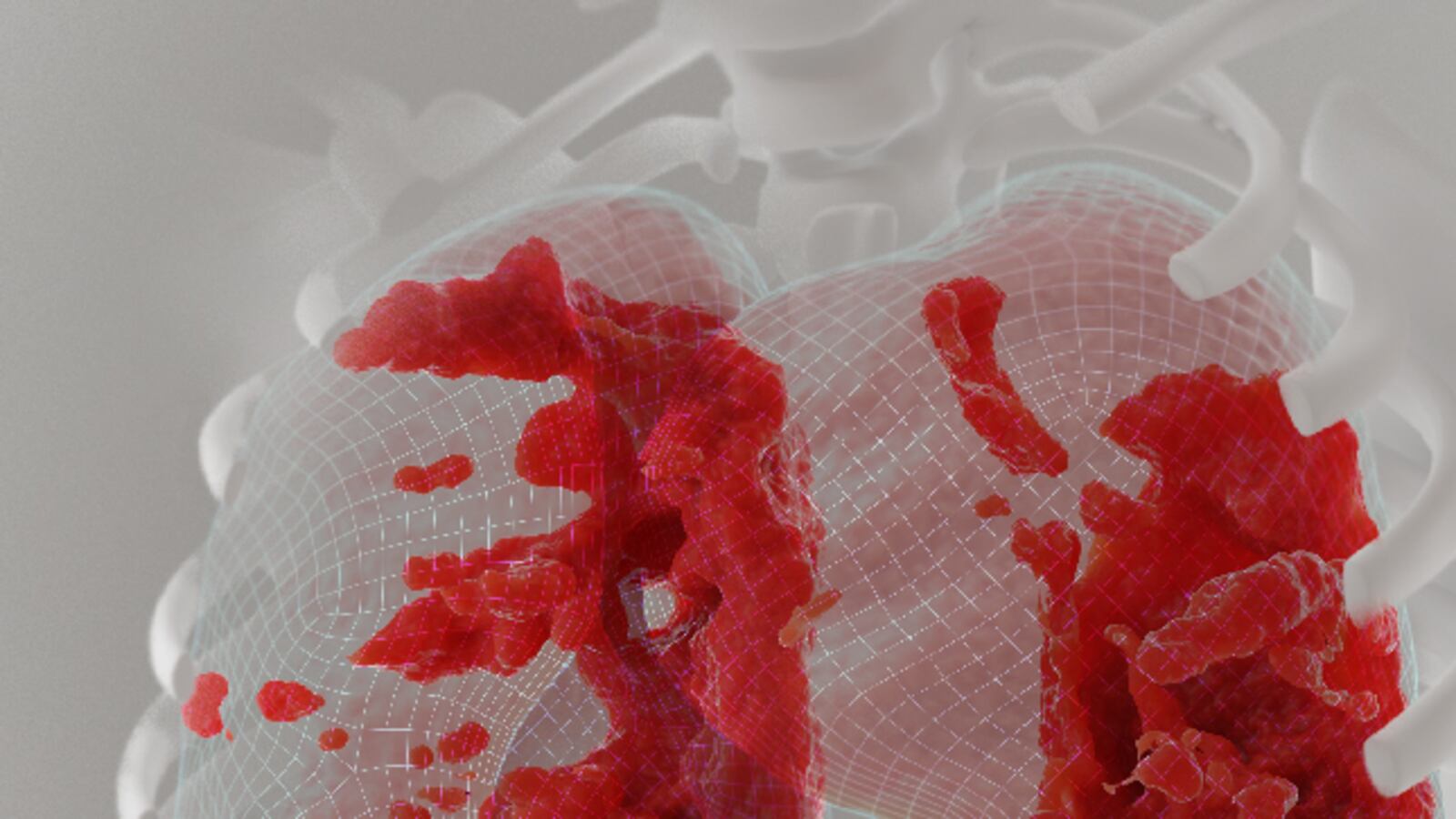 Covid_lungs_web_Main_dclp94