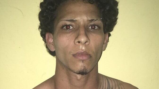 Rolfi-Ferreira-Cruz_imvfdx