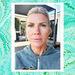 Looker - A 20-Minute Treatment Completely Transformed This Woman's Skin