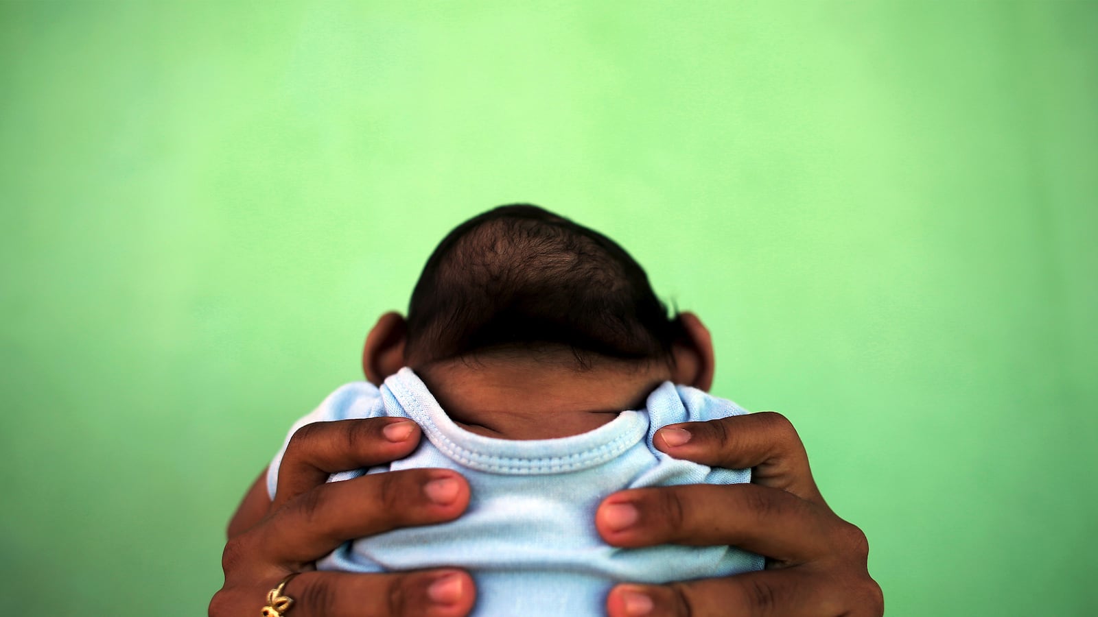 articles/2016/02/16/doctor-zika-virus-likely-causing-brain-damage-worse-than-what-you-re-told/160215-haglage-microcephaly-tease_l7bwox