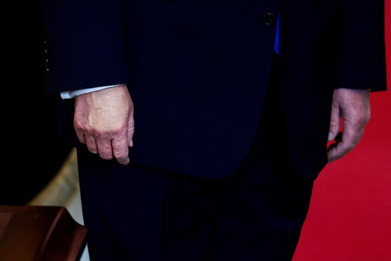 The makeup Trump uses to conceal bruising takes "about ten seconds" to apply, he says.