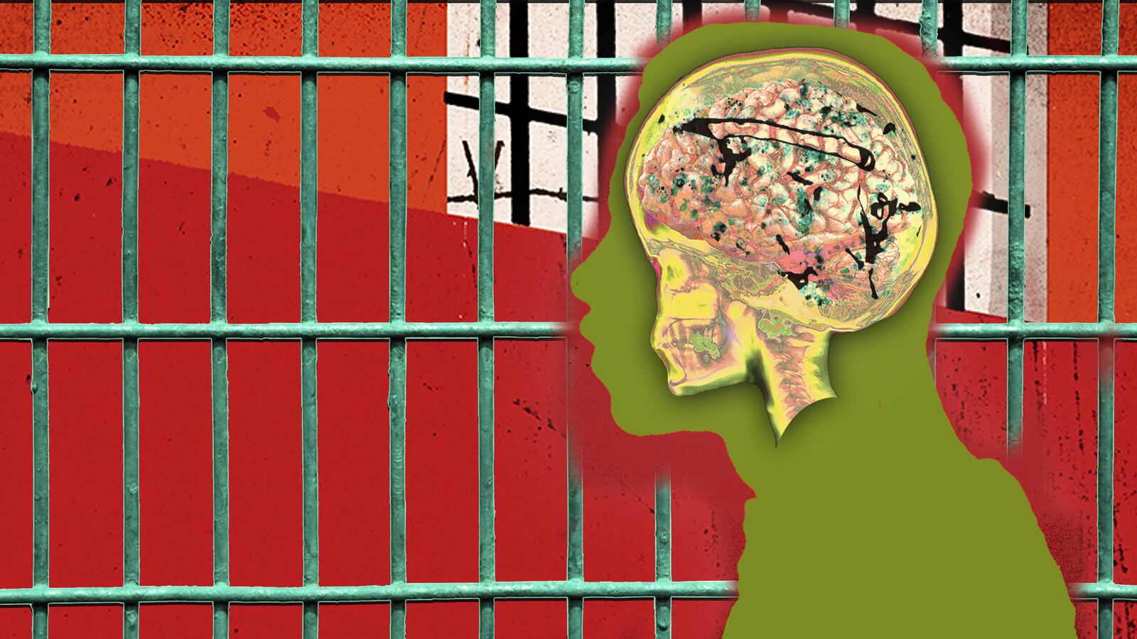 Prison Ignored Inmate’s Pleas as Fungus Ate His Brain, Family Claims