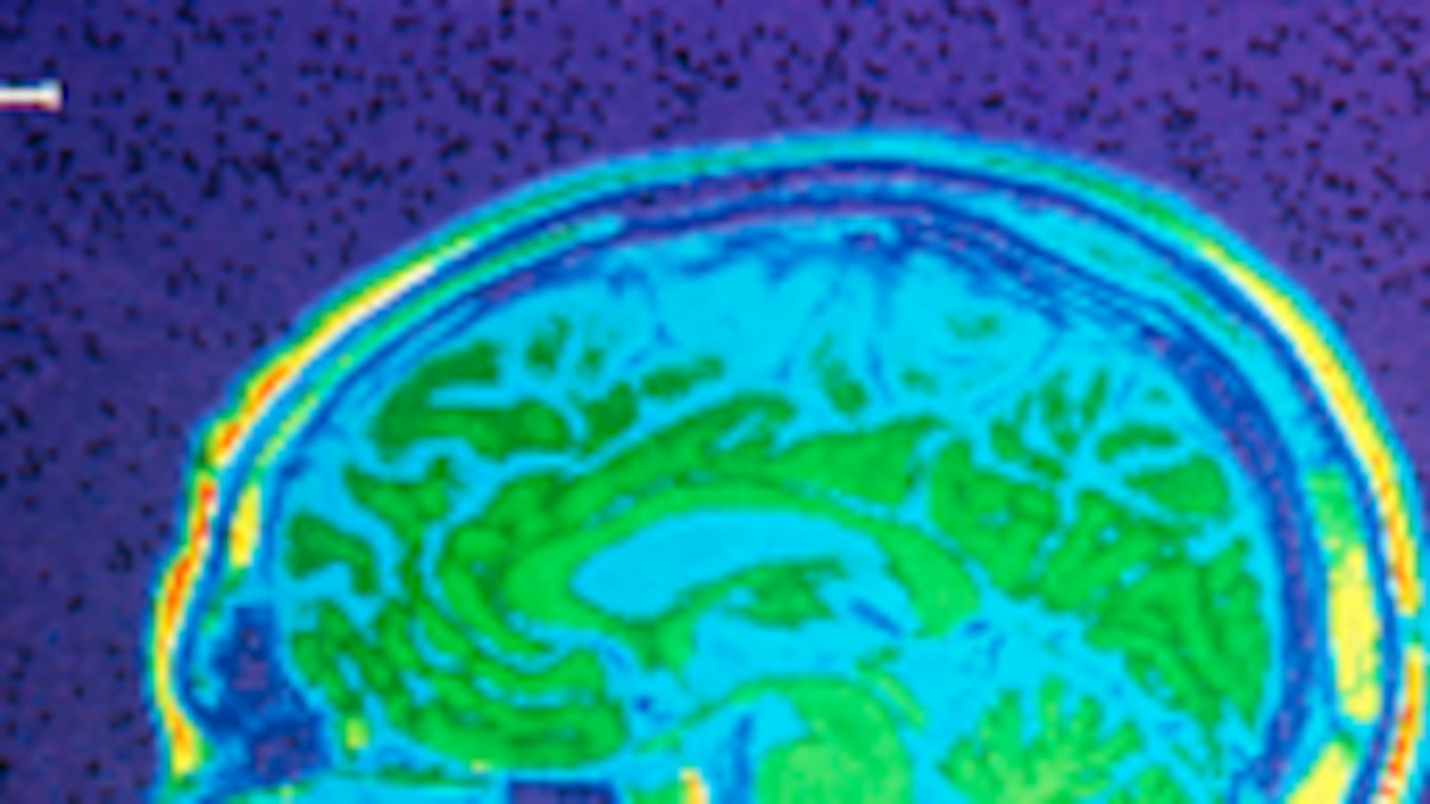 articles/2009/12/10/illustrating-the-brain/schwartz-mri-brain-technology_68747_i3pxls