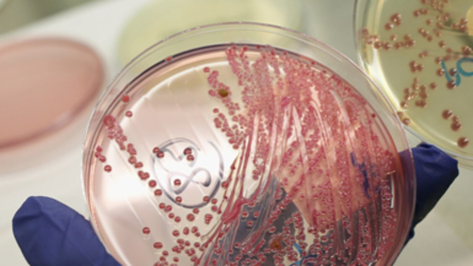 cheats/2011/06/02/e-coli-strain-has-rare-glue/e-coli-strain-unseen-before_lcco7u