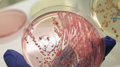 cheats/2011/06/02/e-coli-strain-has-rare-glue/e-coli-strain-unseen-before_lcco7u