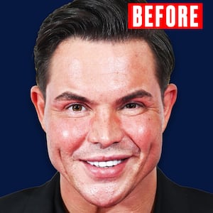 Bobby Norris for the Looker - Before.