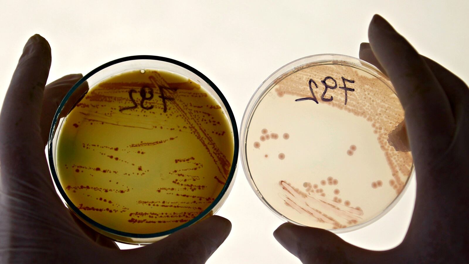 cheats/2016/05/26/antibiotic-resistant-bacteria-now-in-u-s/160526-superbug-antibiotic-cheat_bgtkzj