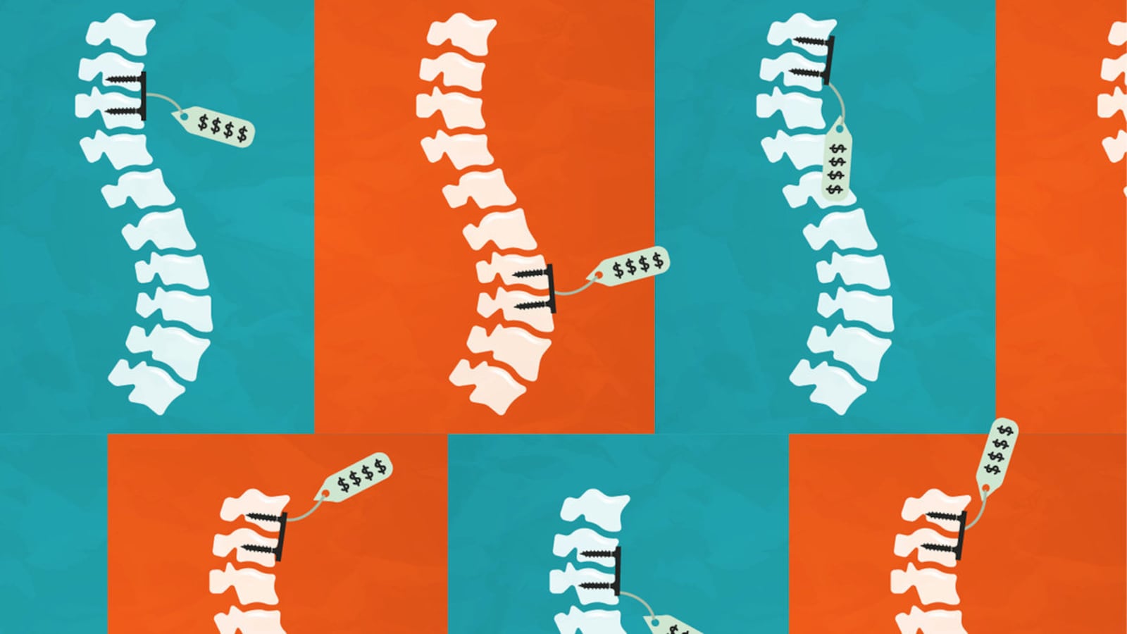 210807-KHN-Surgeons-medical-device-tease_x469ju