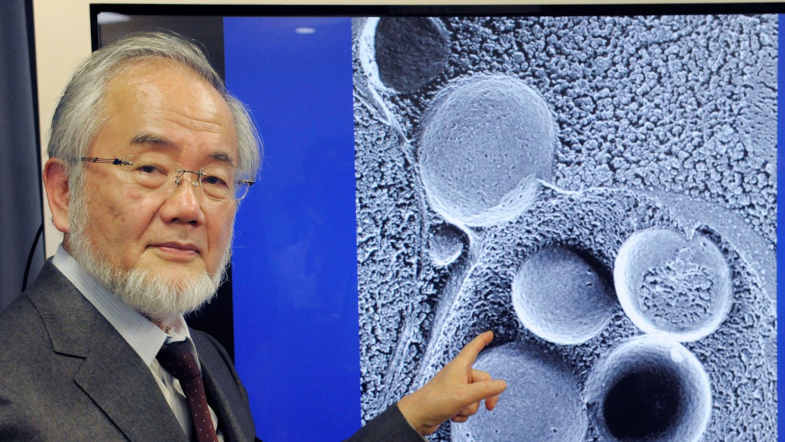 cheats/2016/10/03/yoshinori-ohsumi-wins-medicine-nobel-prize/161003-Yoshinori-Ohsumi-nobel-cheat_z3mypk