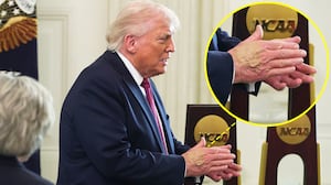 Donald Trump with makeup covering his bruised hand on April 21, 2026.