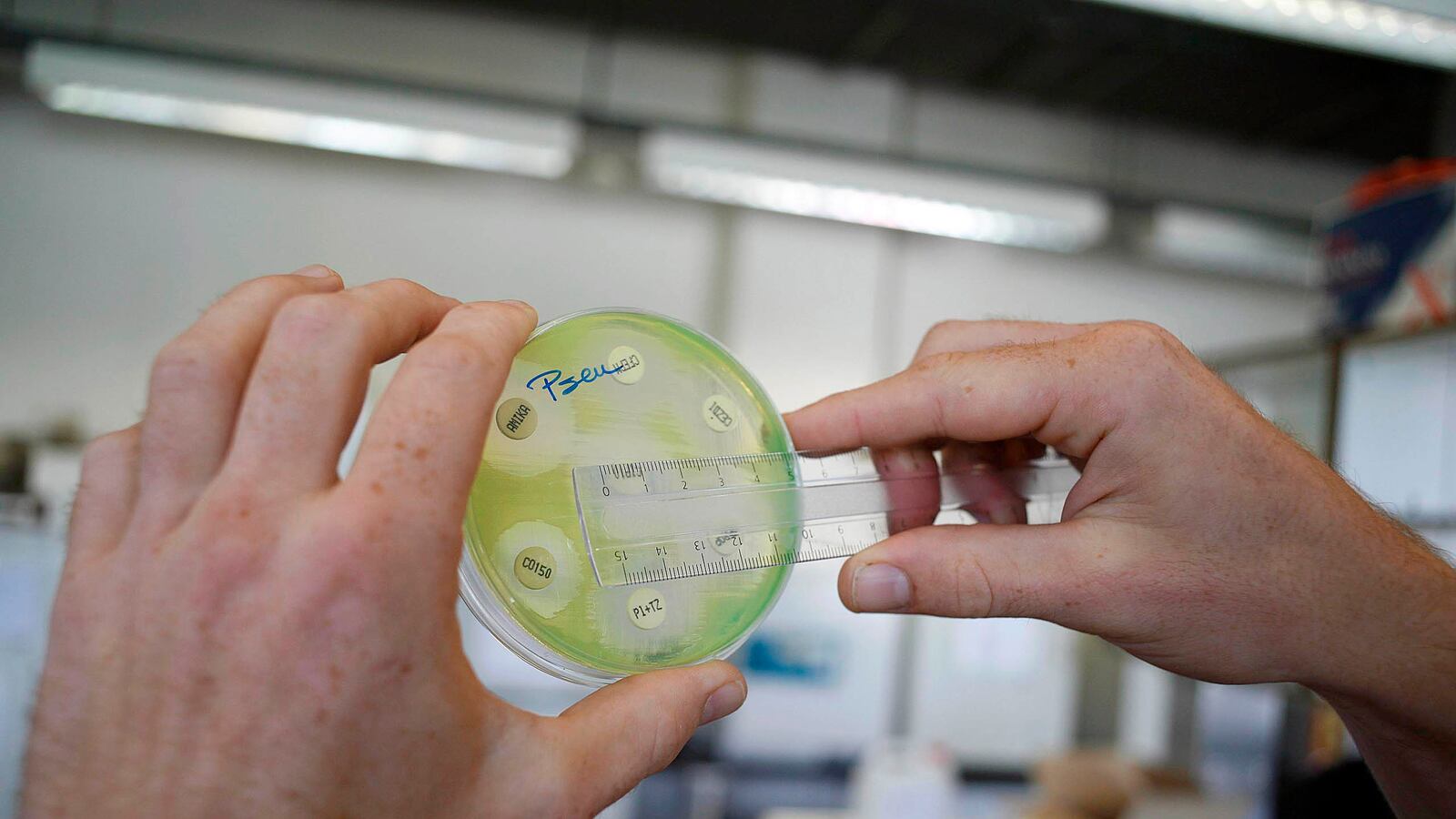 cheats/2016/04/14/drug-resistance-worse-threat-than-cancer/160416-anitbiotic-resistance-cheat_eminya