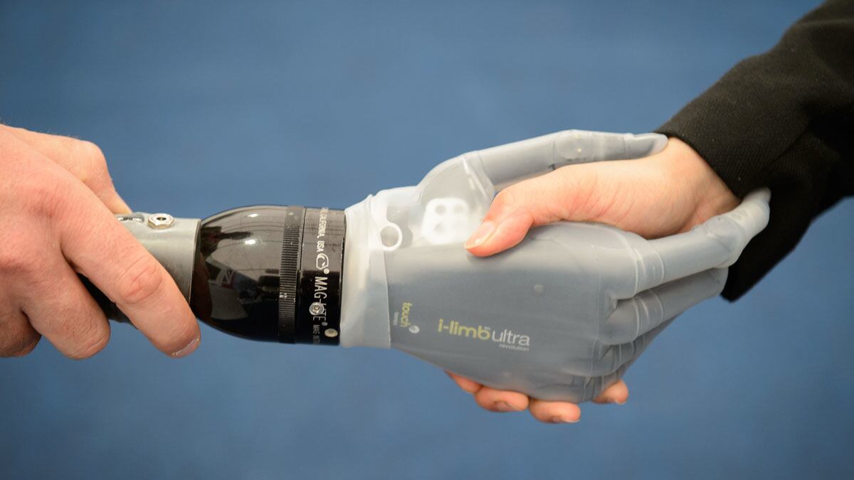 cheats/2014/10/09/bionic-hands-restore-sense-of-touch/141009-hand-cheat_xb9bkm