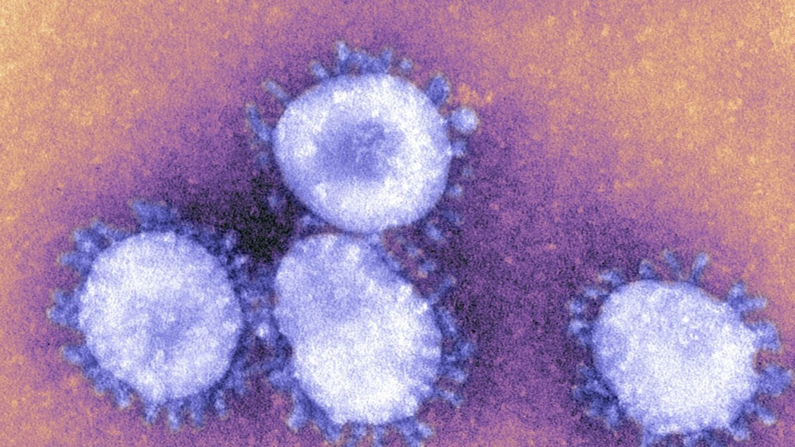 cheats/2013/03/08/cdc-warns-of-deadly-new-virus/CDC-warns-coronavirus-cheat_iq5fwq