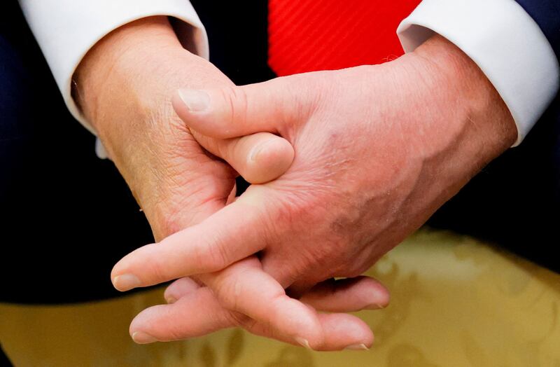 A detail on the hands of U.S. President Donald Trump as he attends a meeting with the President of Poland Karol Nawrocki (not pictured) in the Oval Office at the White House in Washington, D.C., U.S., September 3, 2025.  REUTERS/Brian Snyder     TPX IMAGES OF THE DAY