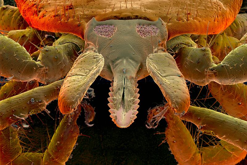 galleries/2013/08/22/accidents-that-freaked-us-out-this-summer/130822-death-tick_i25di6