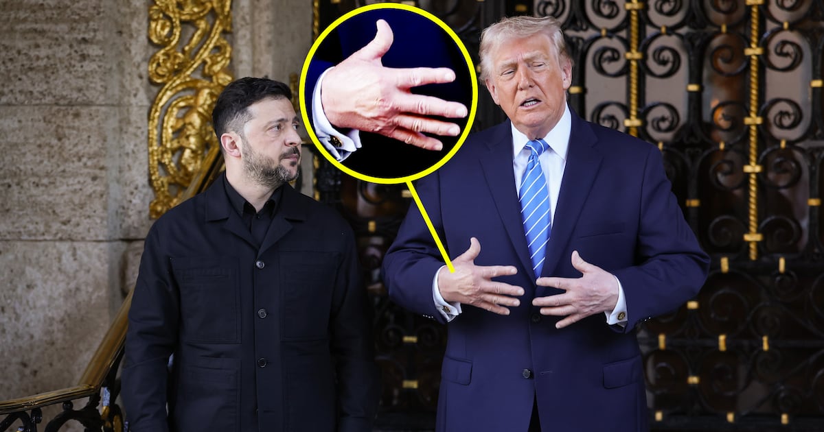 Trump, 79, Slathers on Makeup After Bruising Spotted on Both Hands