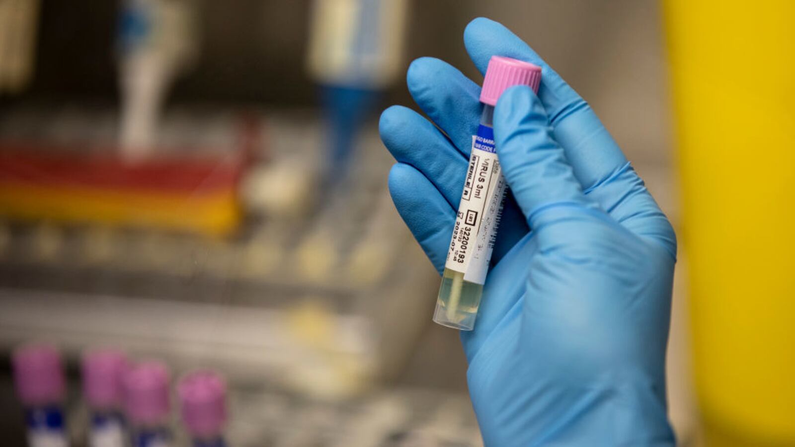 GettyImages-1401334758_nftqek