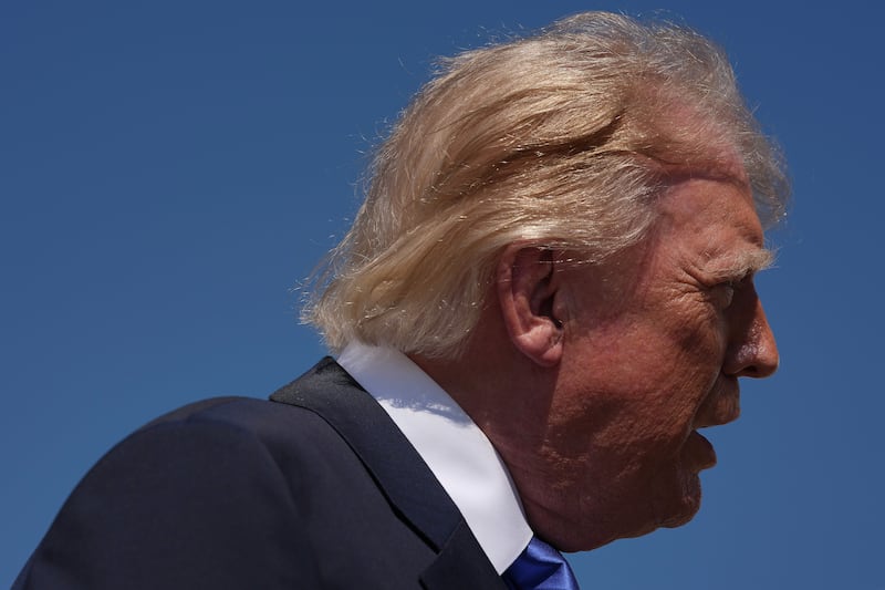 President Donald Trump’s hair was noticeably thinner and lighter than it was as recently as the weekend.