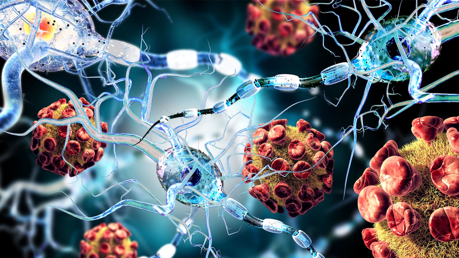 200707-The-Conversation-Guillain-Barre_Syndrome-covid-tease_v9ouza