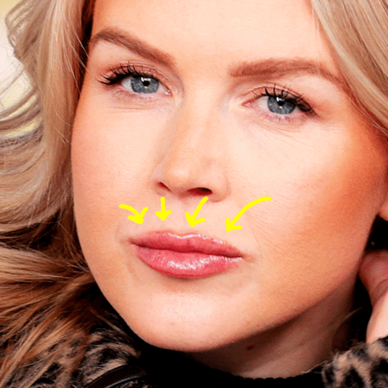 Karoline Leavitt with arrows pointing at her top lip