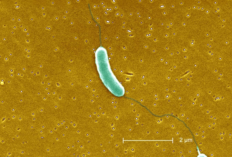 Vibrio Vulnificus,