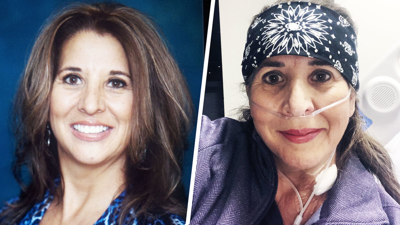 200414-glaser-ventilator-woman-tease_dn2qqg