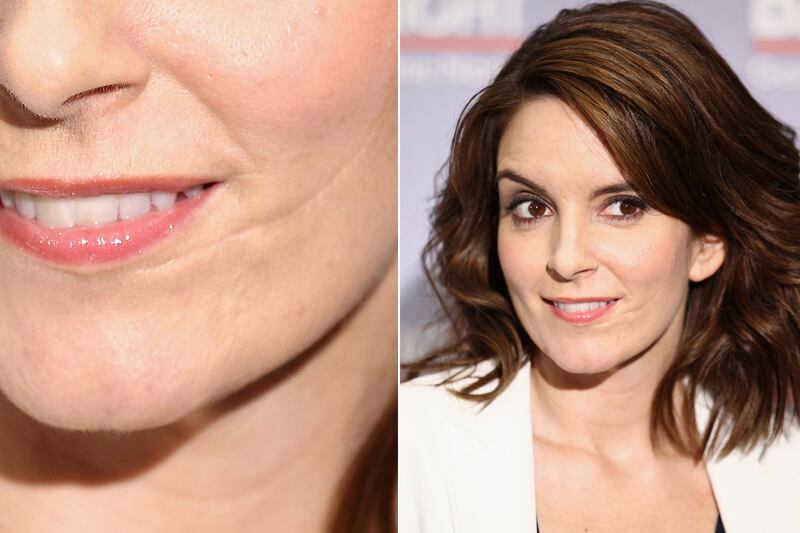 galleries/2011/12/01/kate-middleton-and-other-stars-with-scars-photos/stars-scars-fey_ikrkz8