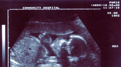 articles/2011/03/23/south-dakotas-abortion-law-violates-separation-of-church-and-state/goldberg-south-dakota-abortion_168700_odnczg