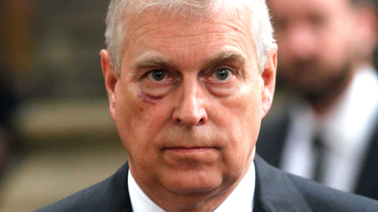 Prince Andrew, Duke of York, with a black eye in 2017. Prince Harry has denied getting into a physical fight with his uncle.