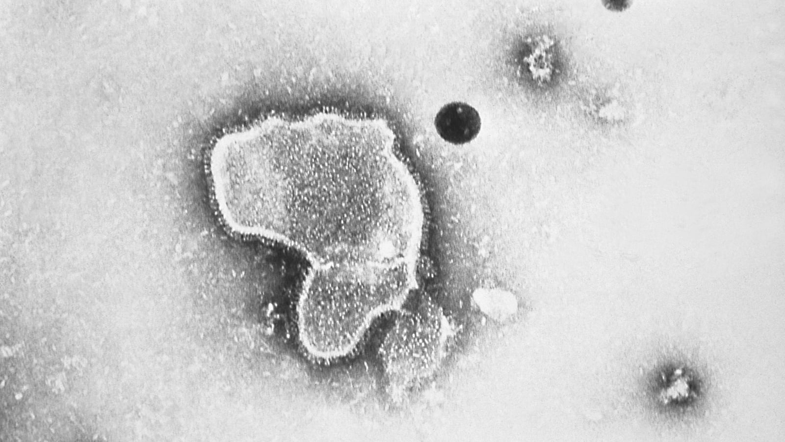 The RSV virus