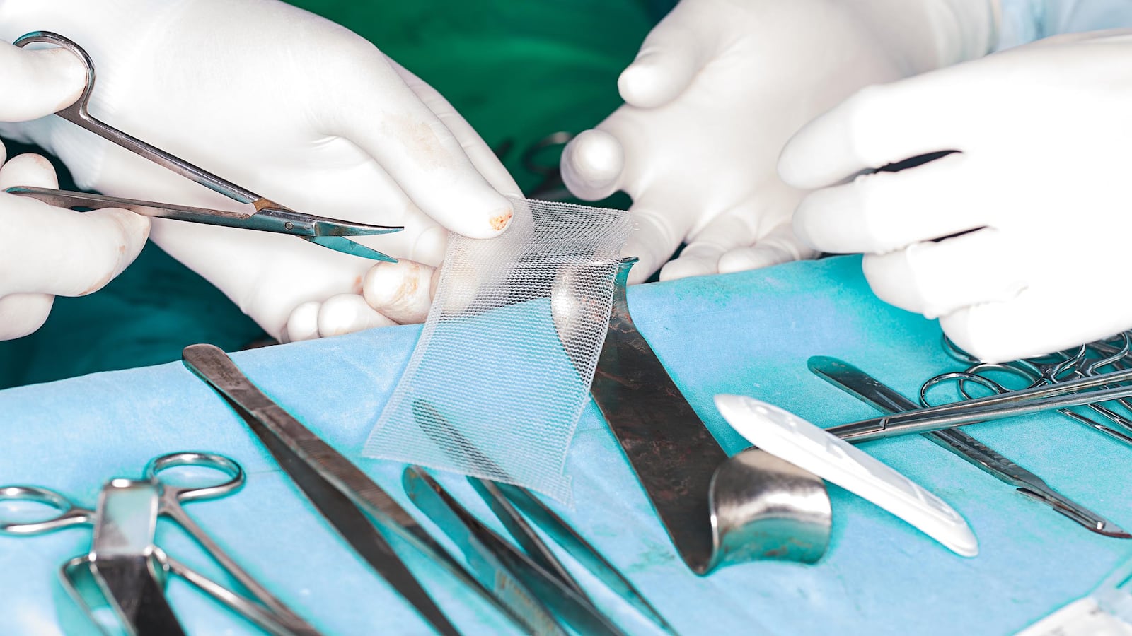 surgeons holding surgical mesh british medical mid urethral sling journal ulf ulmsten jonathan gornall johnson & johnson ethicon tmt vagina vaginal mesh implant transvaginal