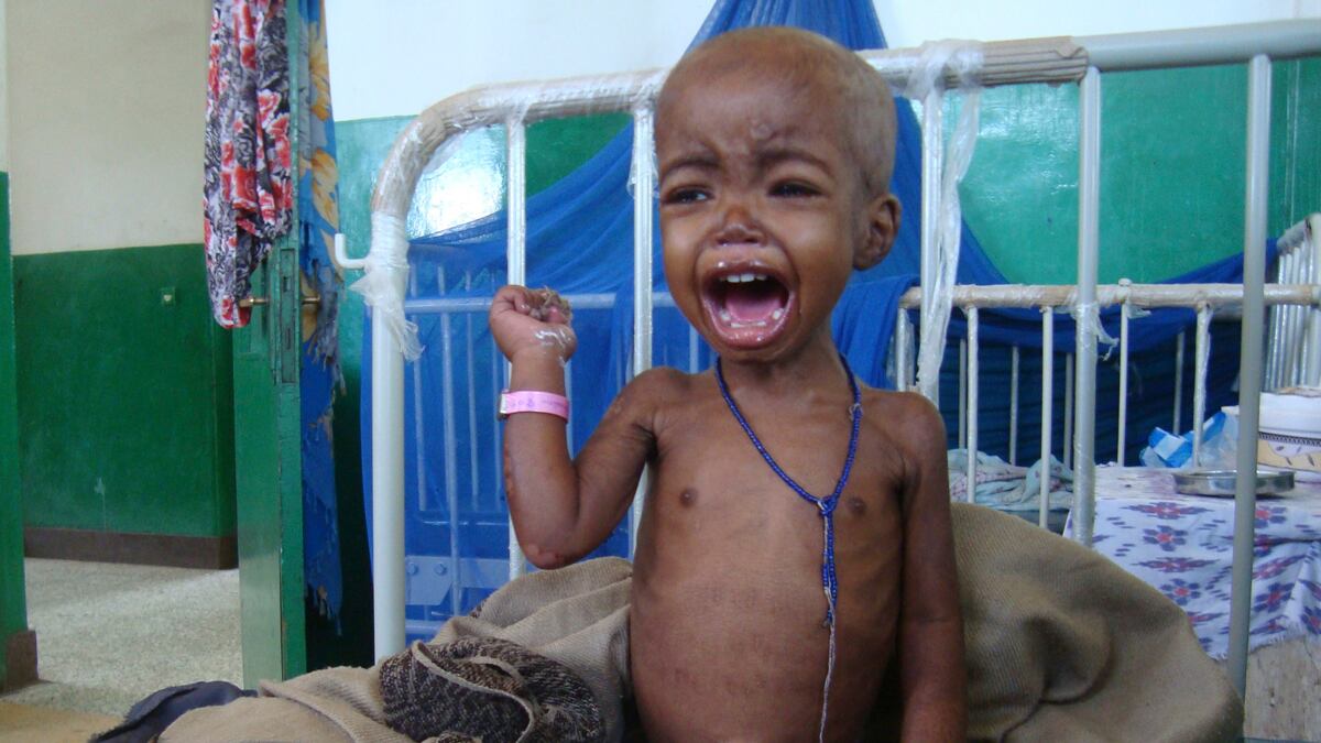 cheats/2011/08/02/somalia-famine-relief-thwarted/somalia-hunger-crisis-cheat_bhgrrd