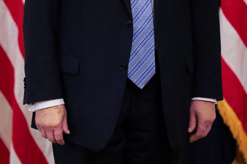 Trump hands