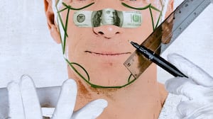 A man recieves mark-ups before a face lift.
