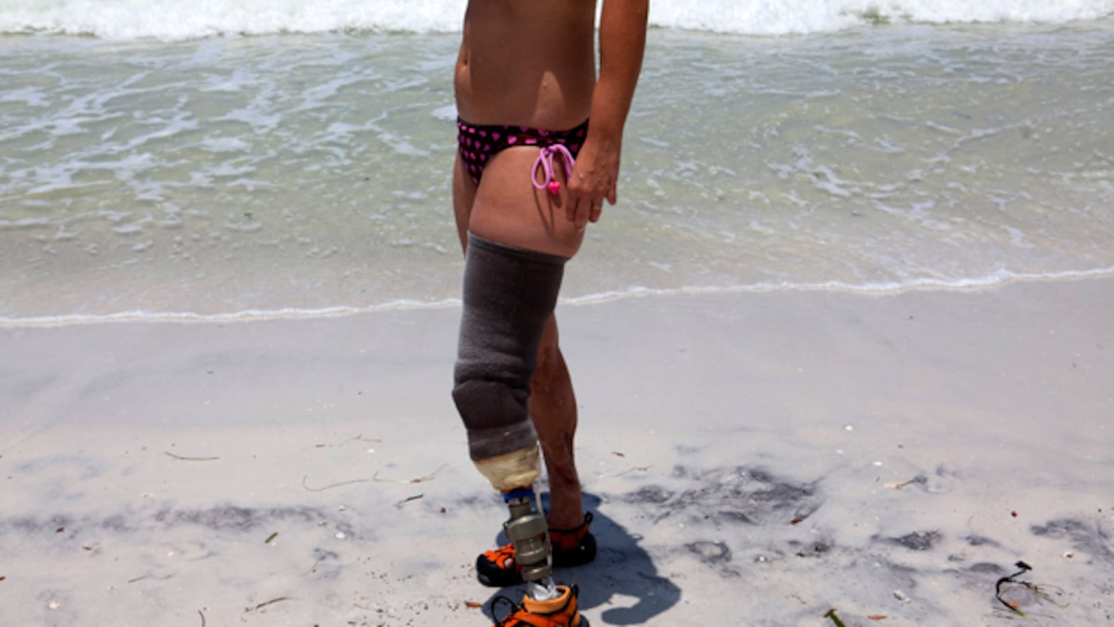 galleries/2009/11/30/high-tech-prosthetics-serve-human-amputees-and-disabled-animals/dolphin-prosthetic-9_duxvah