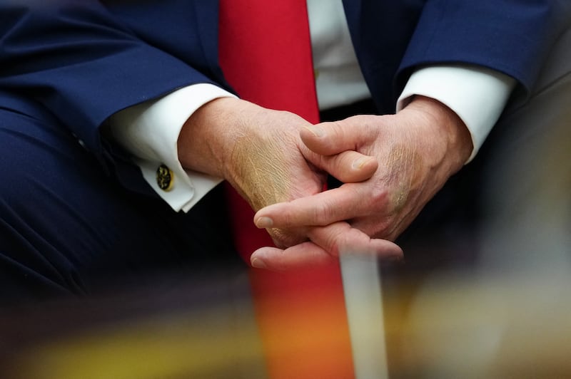 President Donald Trump's makeup covered hands during a meeting in the Oval Office of the White House on June 24, 2026.