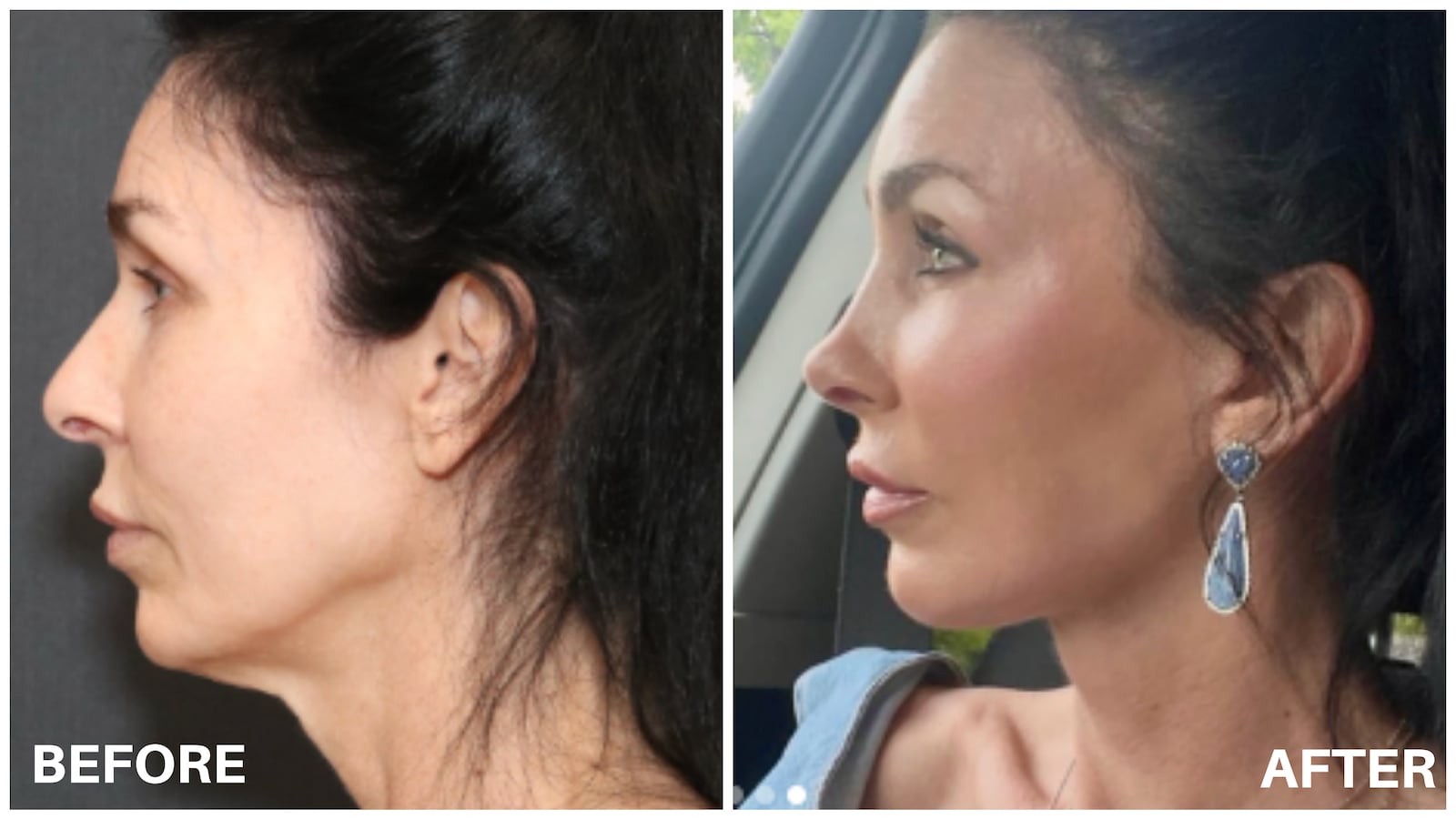 Before-and-after photos of Dr. Nayak's transformation on a client.