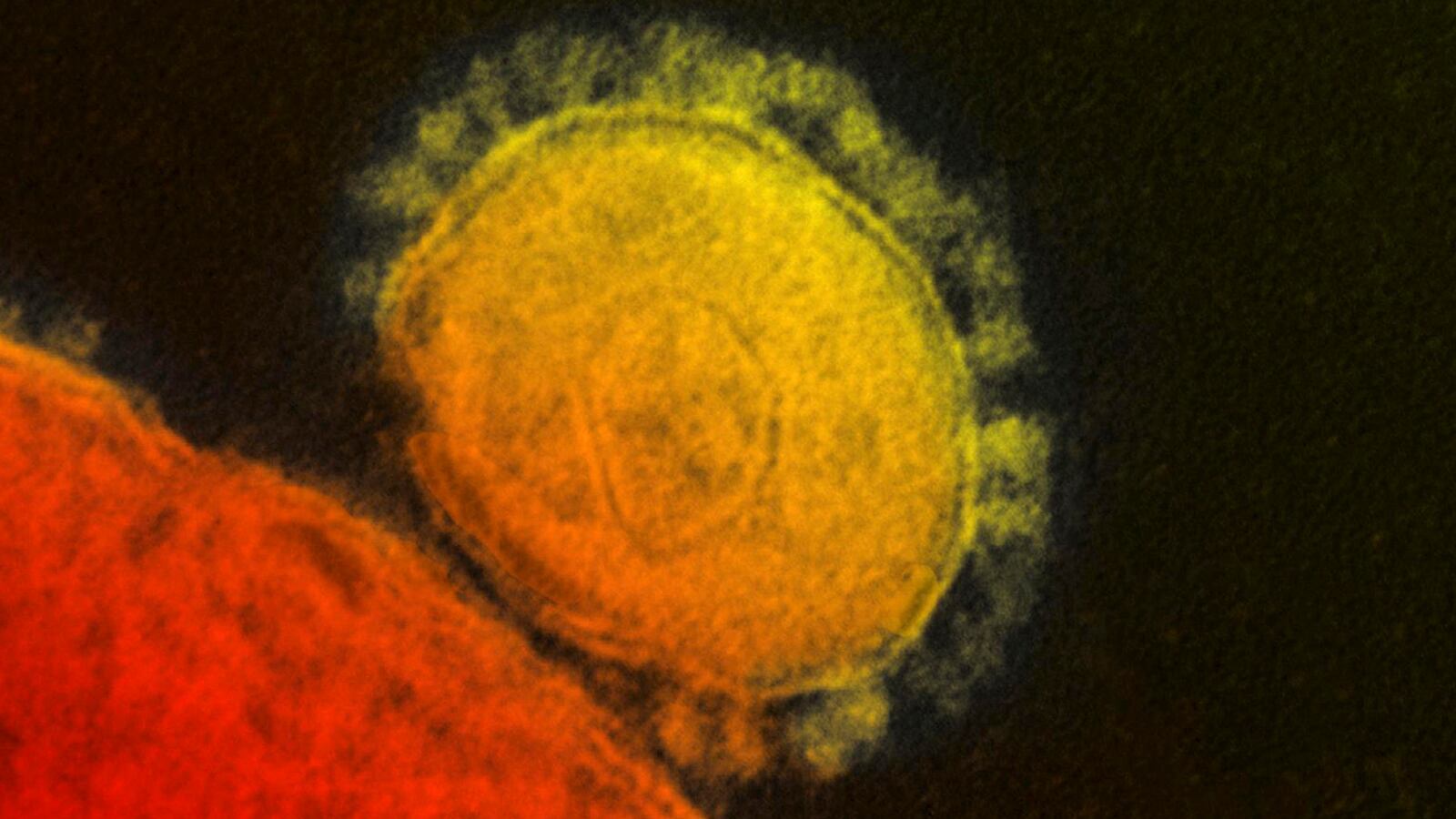 cheats/2014/05/12/2nd-confirmed-mers-case-in-u-s/140512-mers-cheat_vrajj5